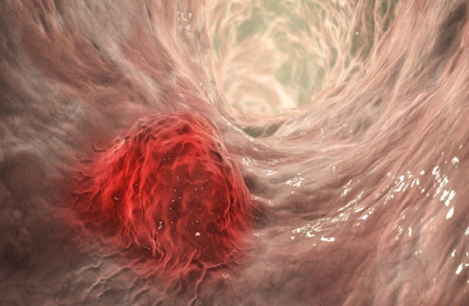 «أسبرين الأطفال».. حبة صغيرة قد تقيك من خطر كبير		 – الخليجي نت