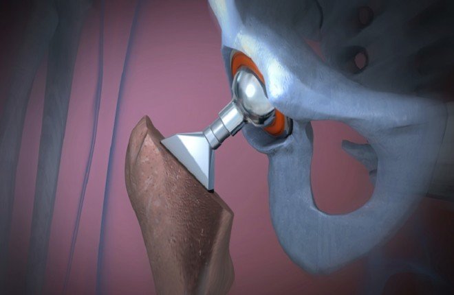 ابتكار علمي يحول البول إلى مادة تستخدم في زراعة العظام والأسنان		 – الخليجي نت