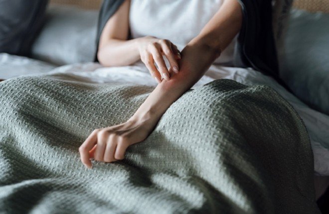 الإكزيما قد تزيد من خطر الإصابة بأمراض الكلى المزمنة		 – الخليجي نت