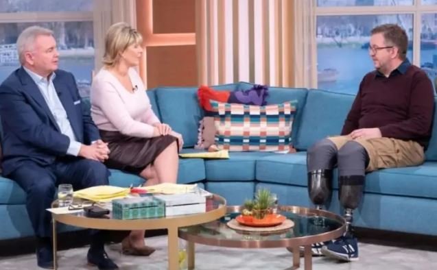 صدق أو لا تصدق.. جراح يبتر ساقيه عمداً ليخدع شركات التأمين		 – الخليجي نت