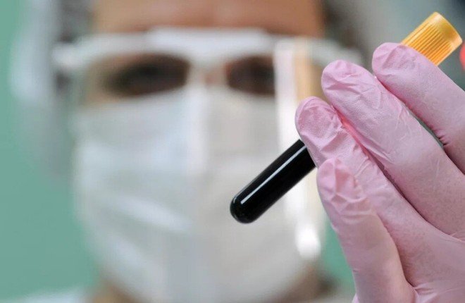 اختراق علمي.. لقاح بجرعة واحدة قد يواجه “كوفيد-19” وفيروس نقص المناعة		 – الخليجي نت