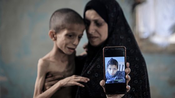 الأزمة الإنسانية في غزة تتفاقم وسط انقسام دولي حاد – الخليجي نت