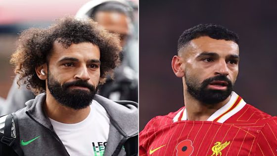 زراعة الشعر.. سر جديد في حياة نجوم الكرة – الخليجي نت