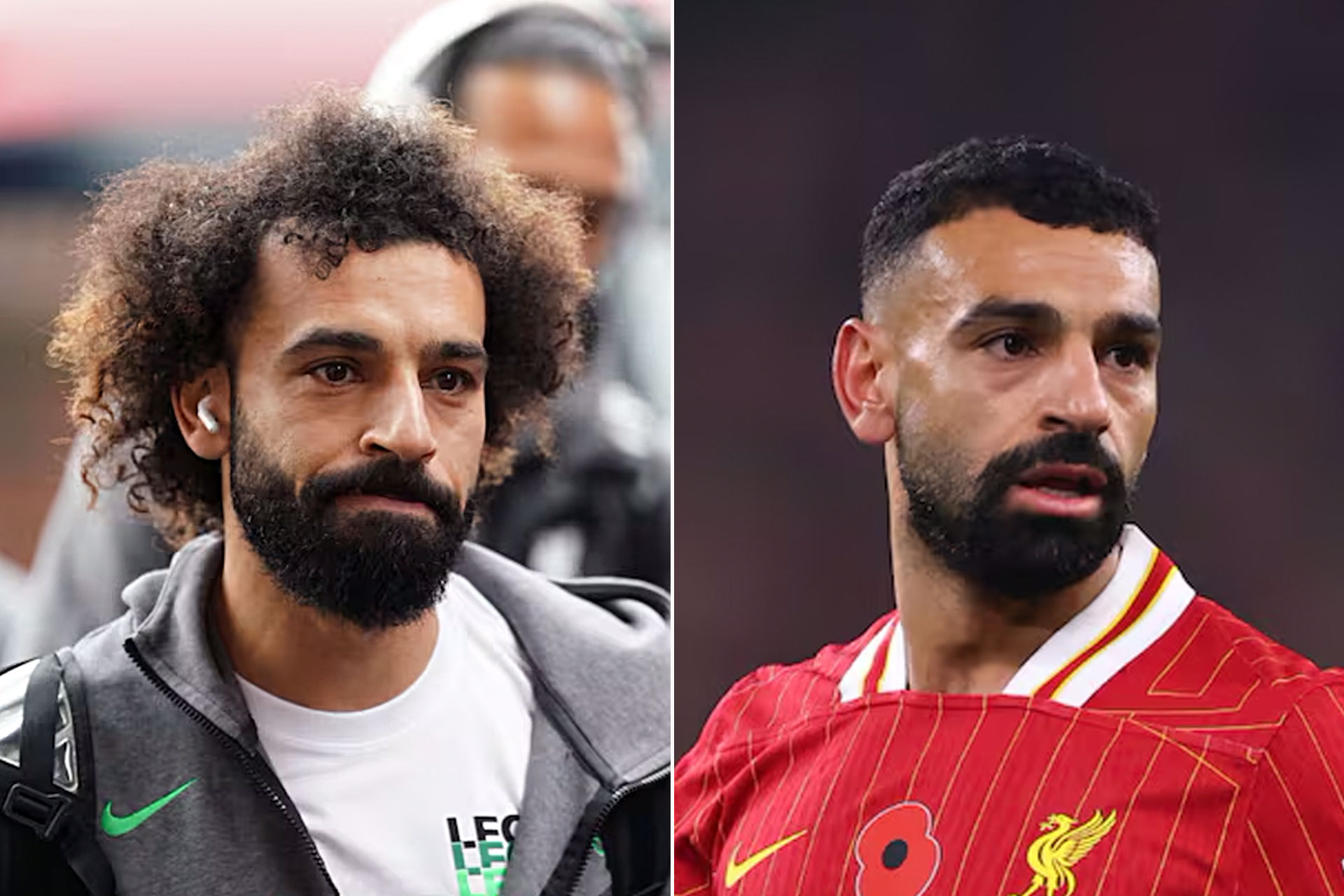 زراعة الشعر.. سر جديد في حياة نجوم الكرة		 – الخليجي نت