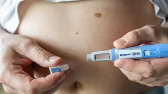 هل يوجد علاقة بين جلطة العين وإبر السمنة؟.. استشاري يجيب – الخليجي نت