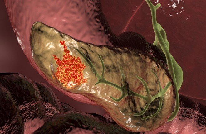 اكتشاف جزيء سكري قد يفتح آفاقاً جديدة لعلاج سرطان البنكرياس		 – الخليجي نت