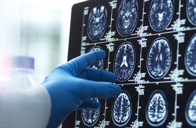 الإمارات تطلق أول تجربة سريرية لتقنية “الذكريات الاصطناعية” لعلاج الزهايمر والخرف		 – الخليجي نت