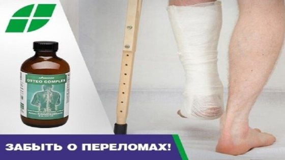 ثورة في جراحة العظام.. الصين تبتكر غراء يثبت الكسور في دقائق ويذوب داخل الجسم – الخليجي نت