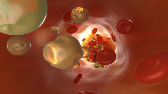 علامة صامتة لارتفاع الكوليسترول غالبا ما تُغفل في الشتاء – الخليجي نت