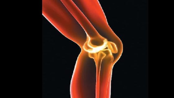 العلاج الأقوى لآلام المفاصل قبل اللجوء إلى الأدوية والجراحة – الخليجي نت