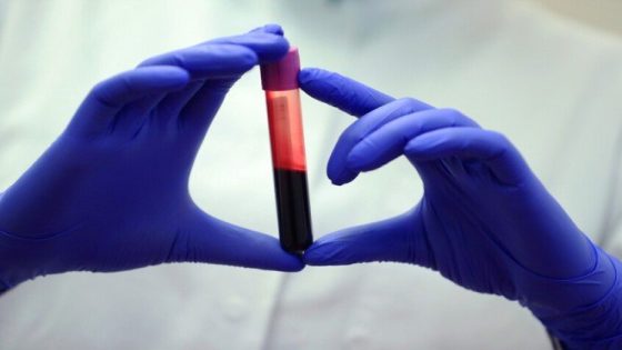 فحص دم ثوري يكشف 50 نوعاً من السرطان قبل ظهور الأعراض – الخليجي نت
