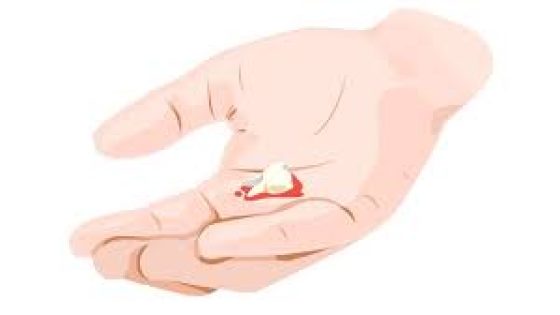 فقدان الأسنان قد يكون نذير شؤم.. ما دلالته؟ – الخليجي نت