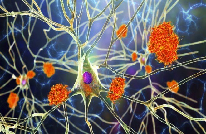 “النبات المعجزة”.. اكتشاف مركبات واعدة في الصبّار قد تمهّد لعلاج ألزهايمر – الخليجي نت