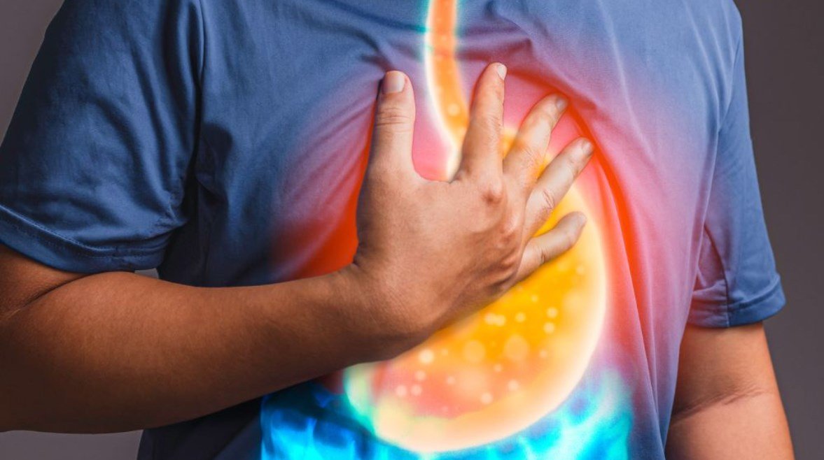 5 نصائح لمرضى ارتجاع المريء في رمضان.. حالة تستدعي زيارة الطبيب
                             – الخليجي نت