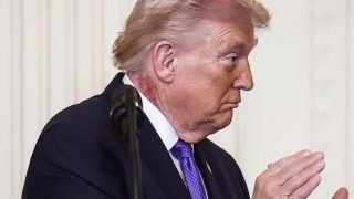 سر البقعة الحمراء في رقبة ترامب.. جدري أم هربس أم سرطان؟
                             – الخليجي نت