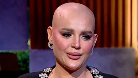 مش هتكسف من شكلي، هبة السيسي تغالب الدموع: رفضت ألبس باروكة دعما لمريضات السرطان – الخليجي نت