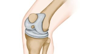 بشرى لكبار السن.. إجراء مبتكر ومنخفض التكاليف لتخفيف آلام الركبة
                             – الخليجي نت
