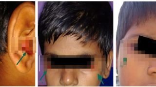 ضريبة الضغط الدراسي.. طفل ينزف دما من عينيه وأذنيه بسبب الامتحانات
                             – الخليجي نت